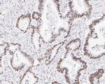 NAT10 Recombinant Rabbit Monoclonal Antibody (JE55-38)