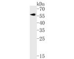 Cytokeratin 12 Antibody in Western Blot (WB)