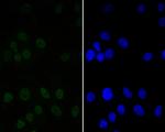 CtBP2 Antibody in Immunocytochemistry (ICC/IF)