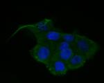 PIM2 Recombinant Rabbit Monoclonal Antibody (JE55-57)