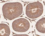 PIM2 Antibody in Immunohistochemistry (Paraffin) (IHC (P))