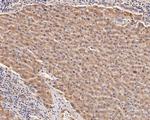PIM2 Antibody in Immunohistochemistry (Paraffin) (IHC (P))