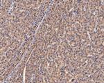 PIM2 Antibody in Immunohistochemistry (Paraffin) (IHC (P))