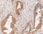 PIM2 Antibody in Immunohistochemistry (Paraffin) (IHC (P))