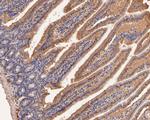 PIM2 Antibody in Immunohistochemistry (Paraffin) (IHC (P))