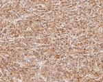 ABH1 Antibody in Immunohistochemistry (Paraffin) (IHC (P))
