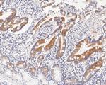 ABH1 Recombinant Rabbit Monoclonal Antibody (JE56-09)