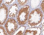 CLGN Antibody in Immunohistochemistry (Paraffin) (IHC (P))