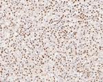 WDR4 Antibody in Immunohistochemistry (Paraffin) (IHC (P))