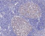 Oct-2 Recombinant Rabbit Monoclonal Antibody (JE58-05)