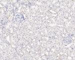 MBD2 Antibody in Immunohistochemistry (Paraffin) (IHC (P))