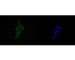 HDGF Recombinant Rabbit Monoclonal Antibody (JE56-32)