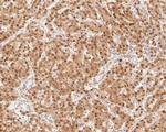 HDGF Antibody in Immunohistochemistry (Paraffin) (IHC (P))