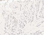 HDGF Antibody in Immunohistochemistry (Paraffin) (IHC (P))