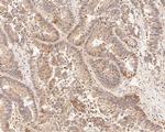 HDGF Antibody in Immunohistochemistry (Paraffin) (IHC (P))