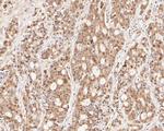 HDGF Antibody in Immunohistochemistry (Paraffin) (IHC (P))