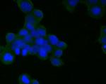 CD21 Monoclonal Antibody (A4E5)