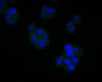 AGTR1 Monoclonal Antibody (11B3)