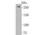 POLR2A Antibody in Western Blot (WB)
