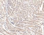 CLIC2 Antibody in Immunohistochemistry (Paraffin) (IHC (P))