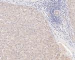 CLIC2 Antibody in Immunohistochemistry (Paraffin) (IHC (P))