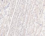 CLIC2 Antibody in Immunohistochemistry (Paraffin) (IHC (P))