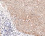 CLIC2 Antibody in Immunohistochemistry (Paraffin) (IHC (P))