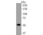 ACVR2B Monoclonal Antibody (A5H7)