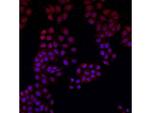 DNMT3L Antibody in Immunocytochemistry (ICC/IF)
