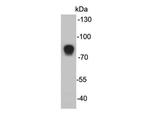 MASP2 Monoclonal Antibody (F3-4)