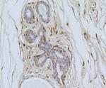 CDK4 Antibody in Immunohistochemistry (Paraffin) (IHC (P))