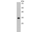 CDK4 Antibody in Western Blot (WB)
