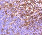 HLA-DR Antibody in Immunohistochemistry (Paraffin) (IHC (P))