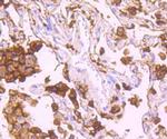 HLA-DR Antibody in Immunohistochemistry (Paraffin) (IHC (P))