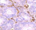 HLA-DR Antibody in Immunohistochemistry (Paraffin) (IHC (P))