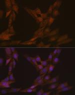 KIFC1 Recombinant Rabbit Monoclonal Antibody (10M10J4)