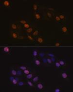 KIFC1 Antibody in Immunocytochemistry (ICC/IF)