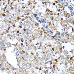 KIFC1 Antibody in Immunohistochemistry (Paraffin) (IHC (P))