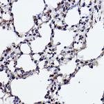 RANBP3 Antibody in Immunohistochemistry (Paraffin) (IHC (P))