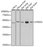 FADS1 Recombinant Rabbit Monoclonal Antibody (1M8L2)