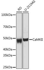 CaMKII pan Recombinant Rabbit Monoclonal Antibody (7L9F0)