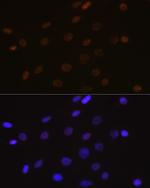 DEK Recombinant Rabbit Monoclonal Antibody (2C2V8)