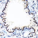 DEK Antibody in Immunohistochemistry (Paraffin) (IHC (P))