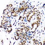 DEK Antibody in Immunohistochemistry (Paraffin) (IHC (P))