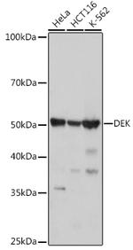 DEK Antibody in Western Blot (WB)