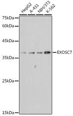 EXOSC7 Recombinant Rabbit Monoclonal Antibody (6E5N8)