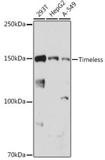 TIMELESS Recombinant Rabbit Monoclonal Antibody (6D4L2)