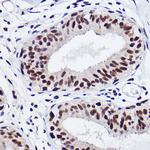 GTF2I Antibody in Immunohistochemistry (Paraffin) (IHC (P))