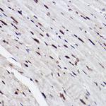 GTF2I Antibody in Immunohistochemistry (Paraffin) (IHC (P))