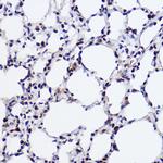 GTF2I Antibody in Immunohistochemistry (Paraffin) (IHC (P))